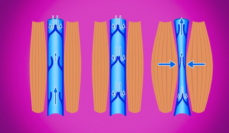Изображение здоровых вен, иллюстрирующее нормальную компрессию вен, которая помогает направлять кровь к сердцу